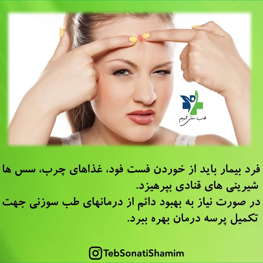 درمان جوش های سر سفید طب سنتی
