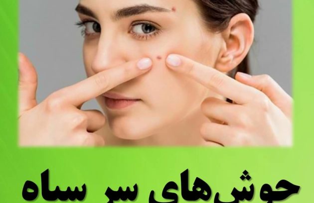 جوش سر سیاه