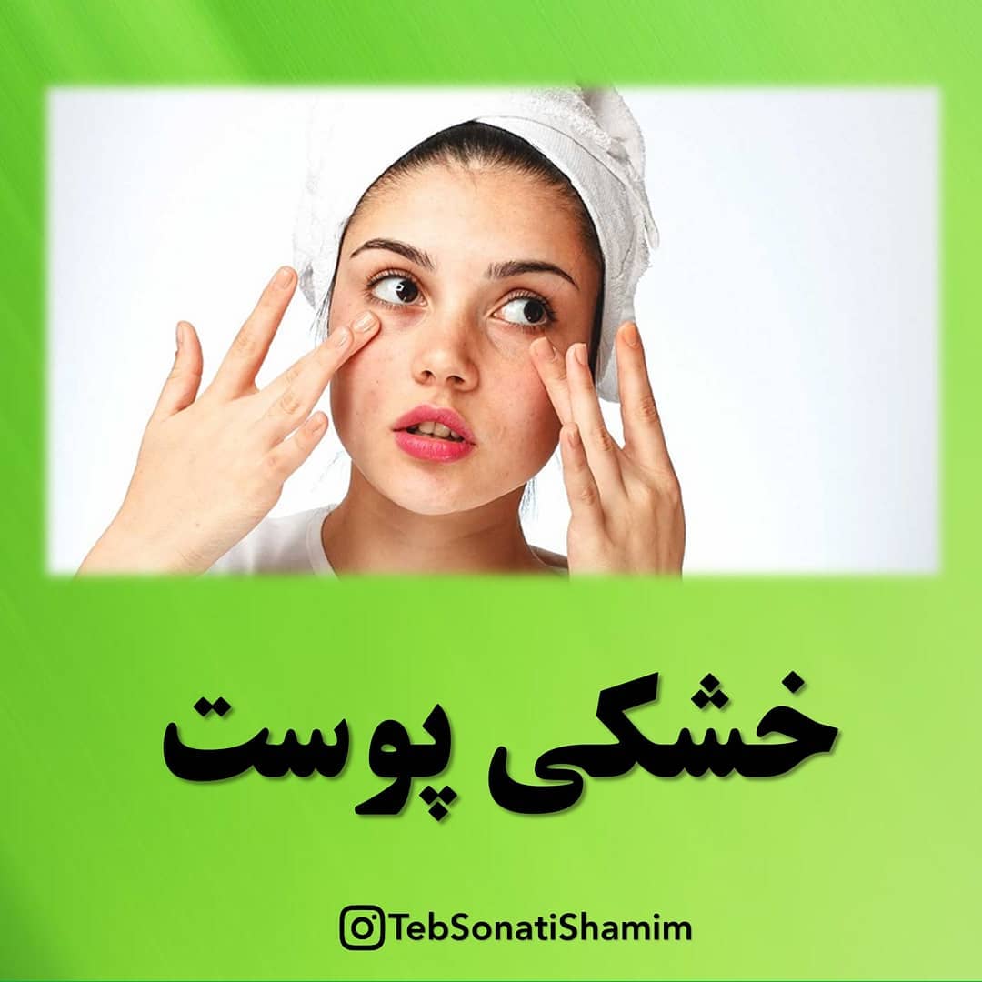 درمان خشکی پوست با طب سنتی