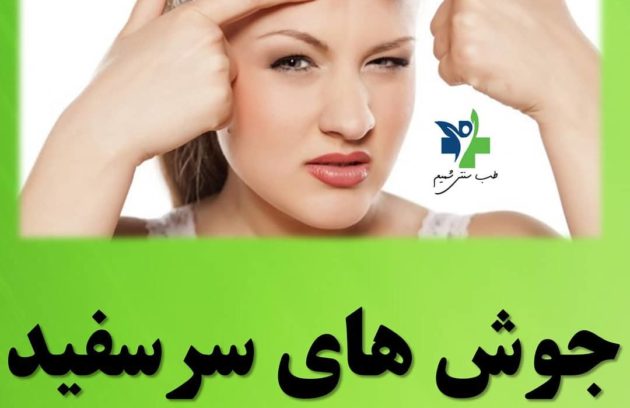 جوش‌ سرسفید