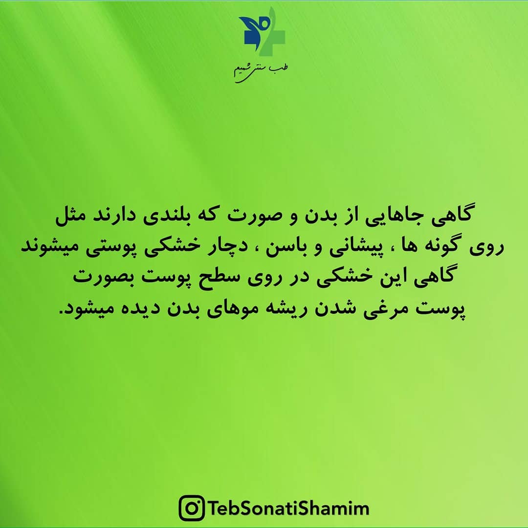 درمان خشکی پوست با طب سنتی