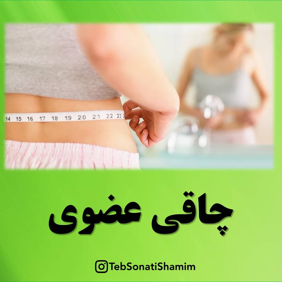 چاقی عضوی | درمان چاقی عضوی