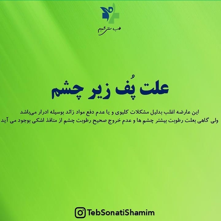 پف زیرچشم | درمان پف زیرچشم