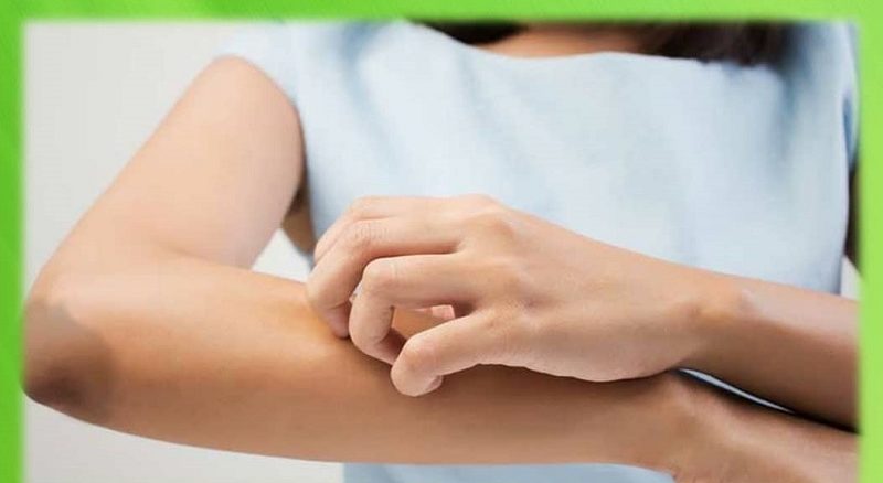 از بین بردن سیاهی زانو و آرنج