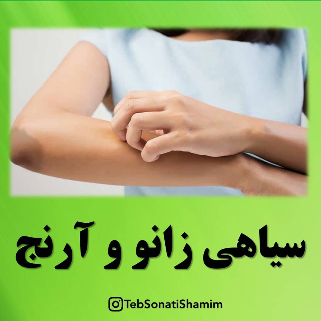 از بین بردن سیاهی زانو و آرنج