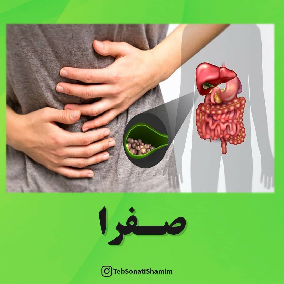 صفرا و طب سنتی