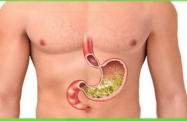 توصیه برای عملکرد بهتر معده