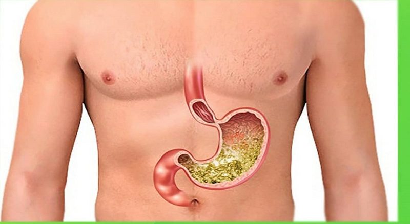 توصیه برای عملکرد بهتر معده