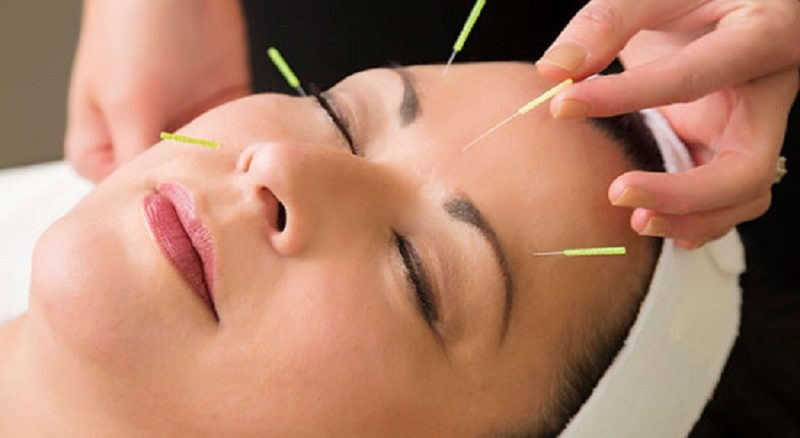 آيا واقعآ طب سوزنی اثر می كند؟