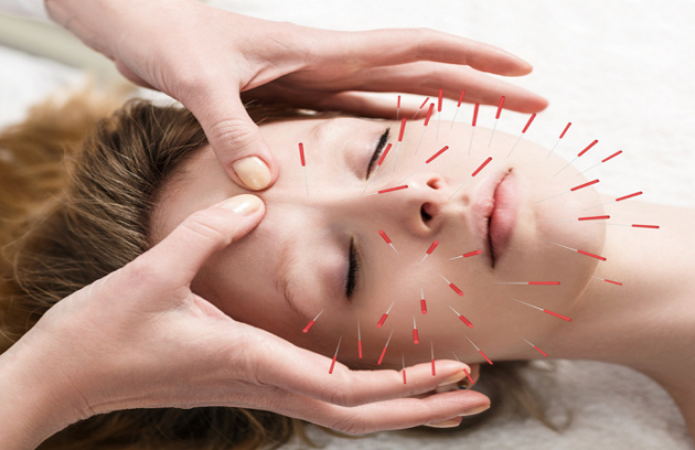 مرکز طب سوزنی کرج