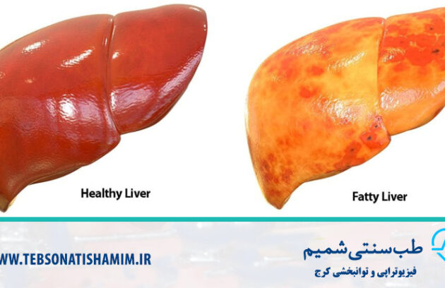 فیزیوتراپی و توانبخشی کرج
