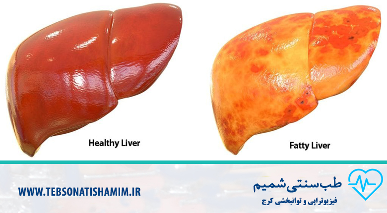 فیزیوتراپی و توانبخشی کرج