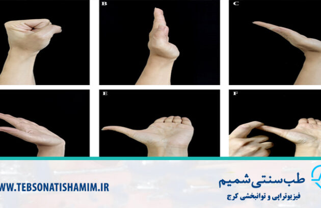 فیزیوتراپی و توانبخشی کرج