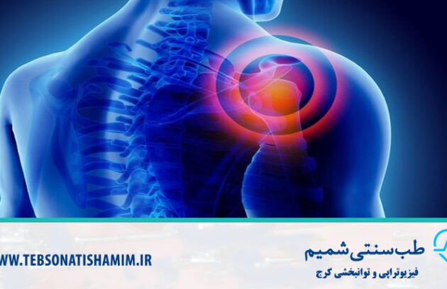 فیزیوتراپی و توانبخشی کرج