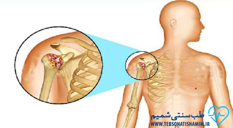 فیزیوتراپی و توانبخشی کرج