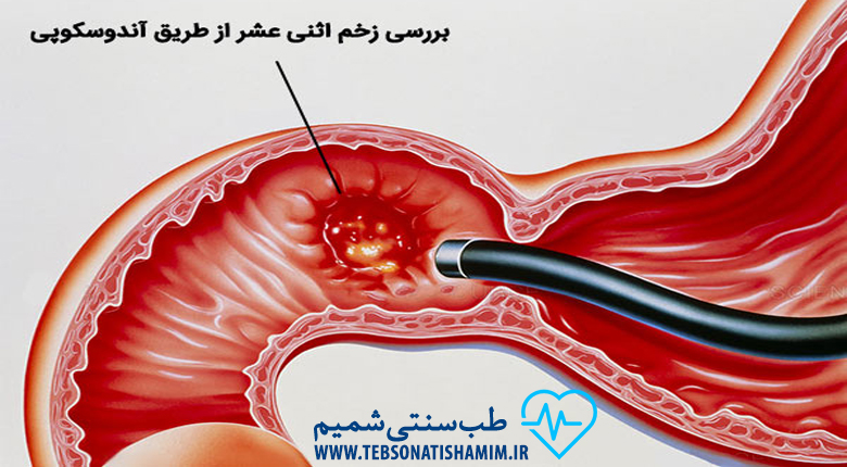 درمان بیماری گوارشی