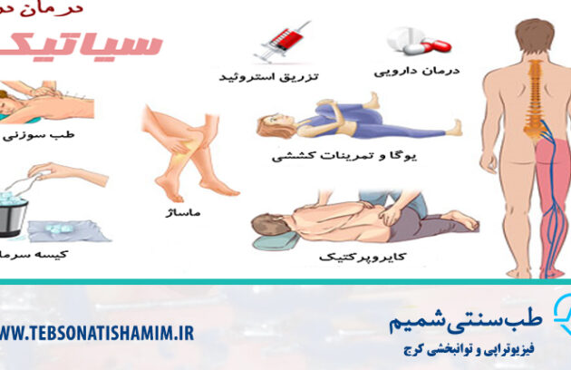 رفع درد سیاتیک