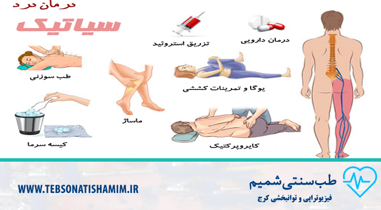 رفع درد سیاتیک