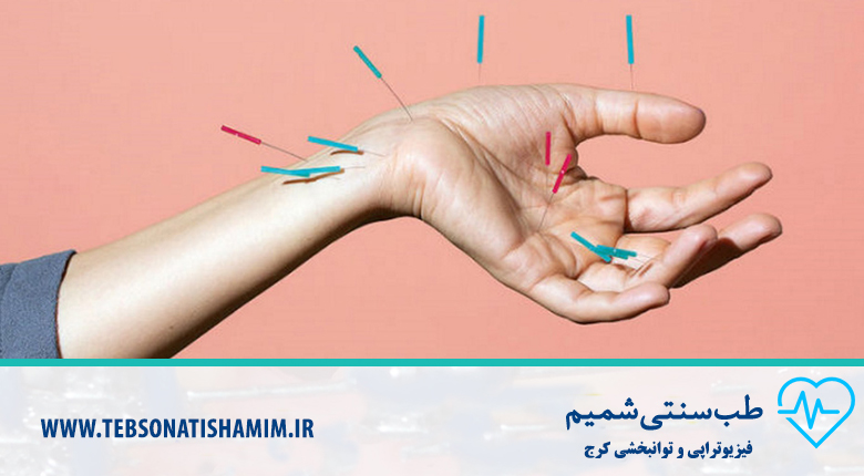 درمان ناباروری زنان با طب سوزنی در کرج