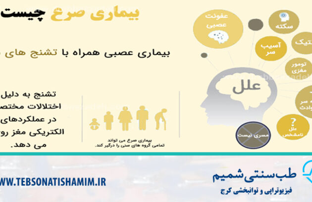درمان بیماری صرع