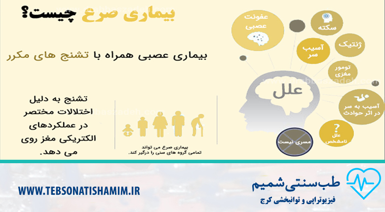 درمان بیماری صرع