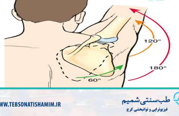 فیزیوتراپی و توانبخشی کرج
