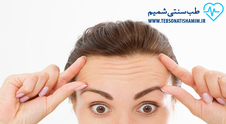 کرم های چین و چروک