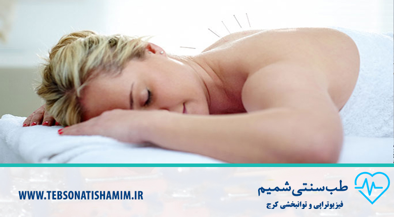 درمان بیماری با طب سوزنی