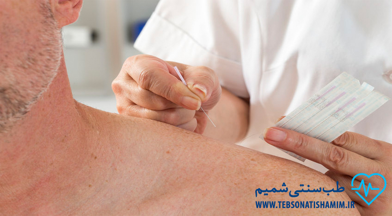 طب سوزنی کرج