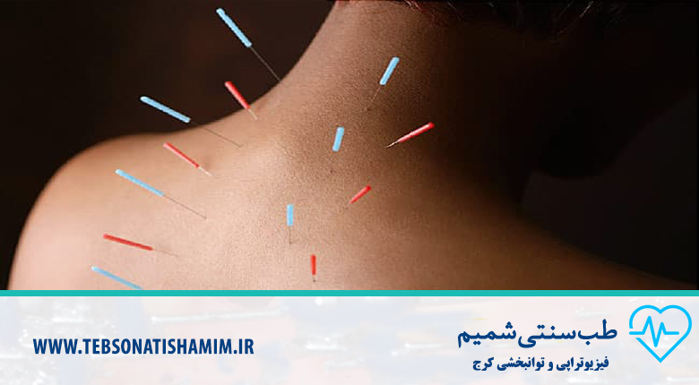 طب سوزنی کرج