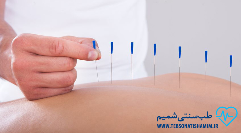 طب سوزنی کرج