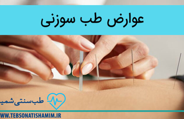 عوارض احتمالی طب سوزنی