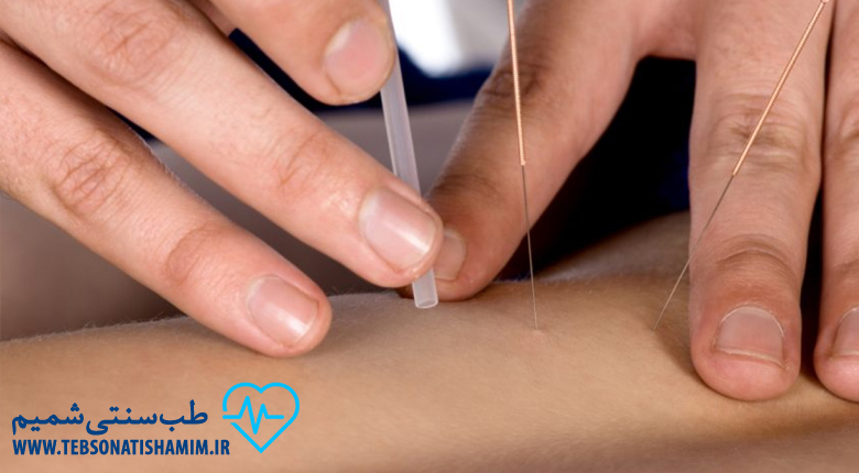 طب-سوزنی-کرج