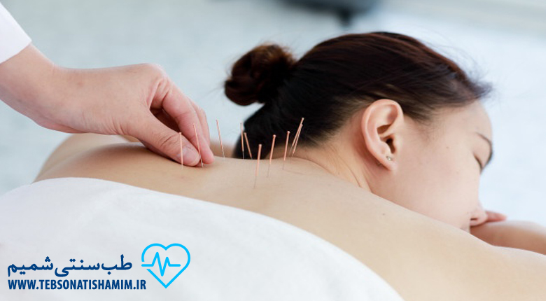 عوارض احتمالی طب سوزنی