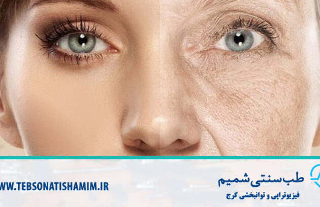 پیشگیری از پیری زودرس