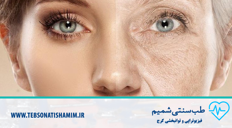 پیشگیری از پیری زودرس