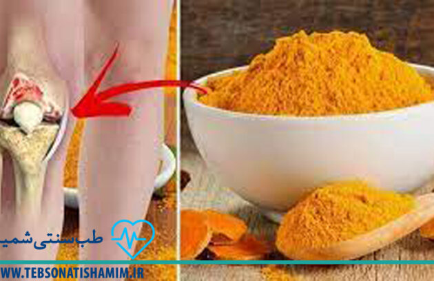 درمان زانو درد