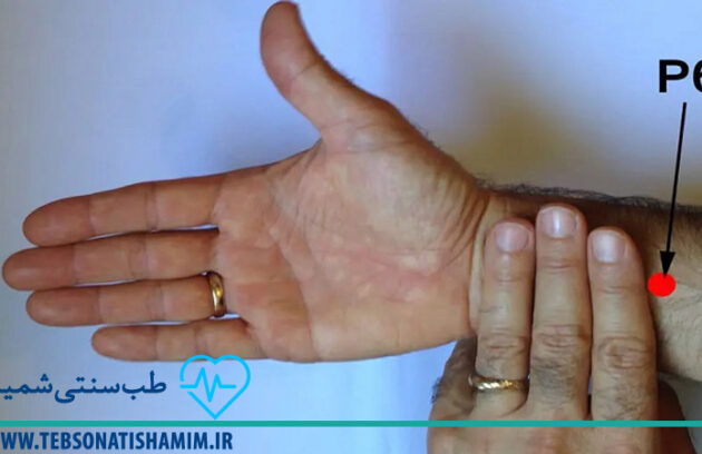 فیزیوتراپی-و-توانبخشی-کرج | طب-سوزنی-در-کرج