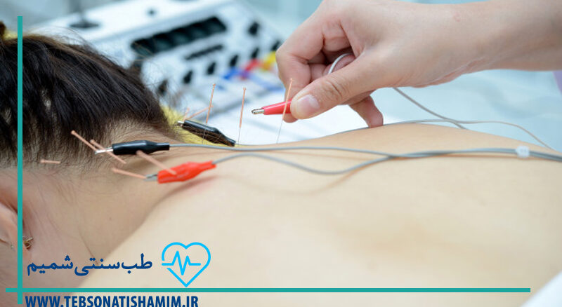 فیزیوتراپی-و-توانبخشی-کرج | طب-سوزنی-در-کرج | طب-سنتی-شمیم-سبز