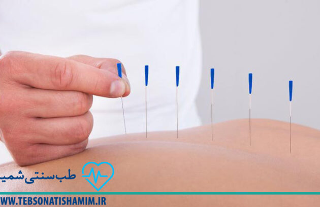 فیزیوتراپی-و-توانبخشی-کرج | طب-سوزنی-در-کرج | طب-سنتی-شمیم-سبز