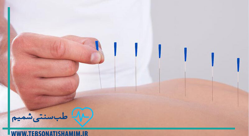 فیزیوتراپی-و-توانبخشی-کرج | طب-سوزنی-در-کرج | طب-سنتی-شمیم-سبز