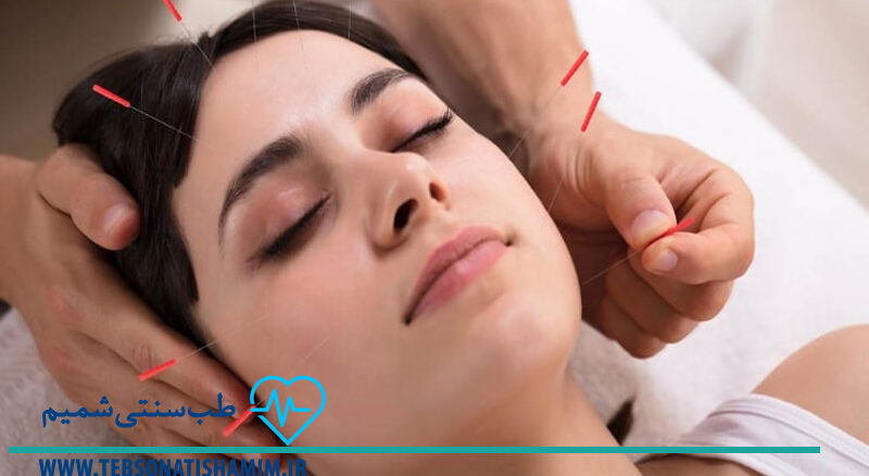 فیزیوتراپی و توانبخشی کرج | طب سوزنی در کرج