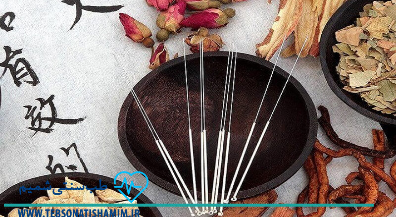 فیزیوتراپی و توانبخشی کرج | طب سوزنی در کرج
