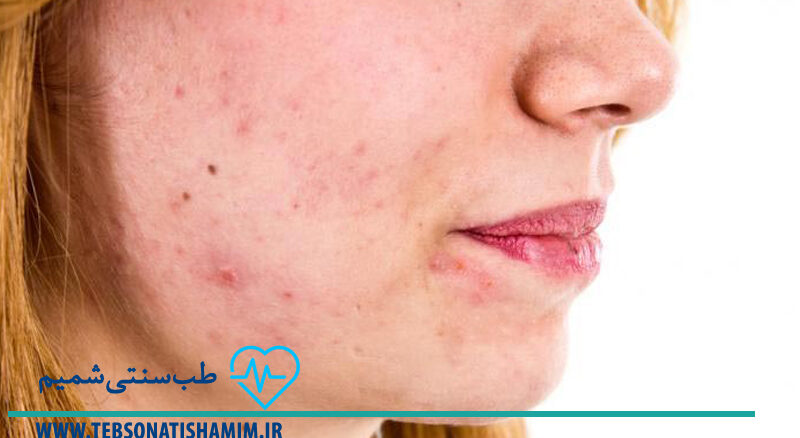 فیزیوتراپی و توانبخشی کرج | طب سوزنی در کرج