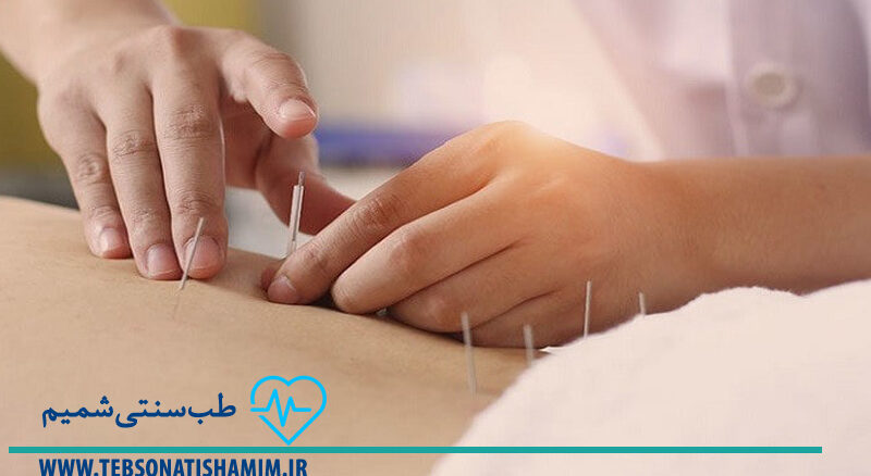 فیزیوتراپی و توانبخشی کرج | طب سوزنی در کرج