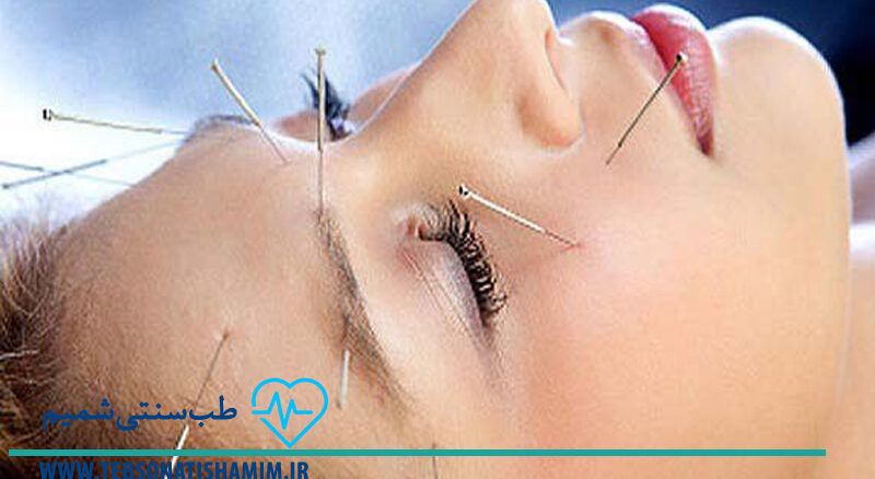 فیزیوتراپی و توانبخشی کرج | طب سوزنی در کرج
