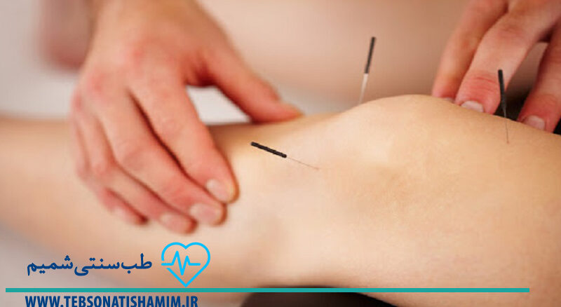 فیزیوتراپی و توانبخشی کرج | طب سوزنی در کرج