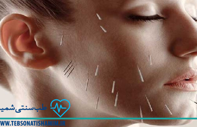فیزیوتراپی و توانبخشی کرج | طب سوزنی در کرج