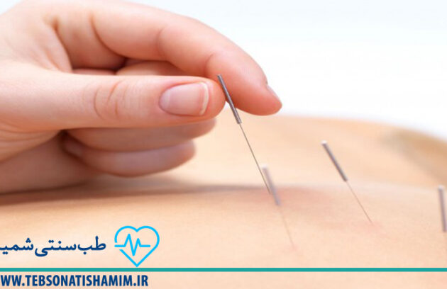 فیزیوتراپی و توانبخشی کرج | طب سوزنی در کرج