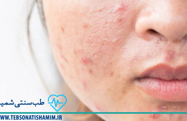 فیزیوتراپی و توانبخشی کرج | طب سوزنی در کرج